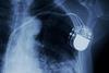 EMA Pilot Image