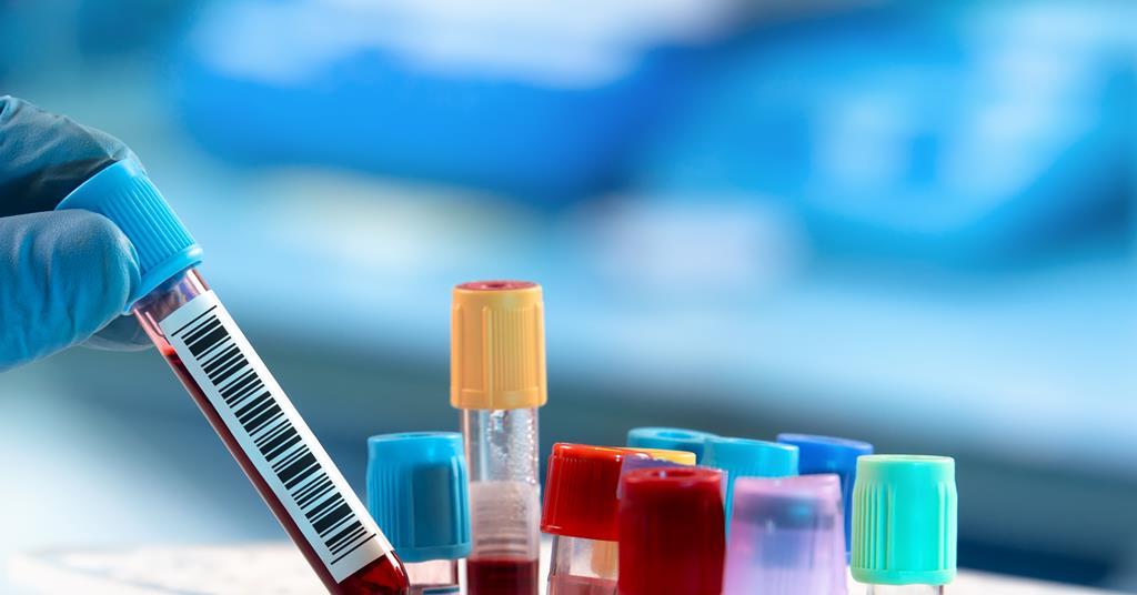 Researchers aim to diagnose Alzheimer’s through blood test Industry