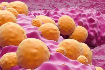 DERMASENSOR-Basal cell carcinoma